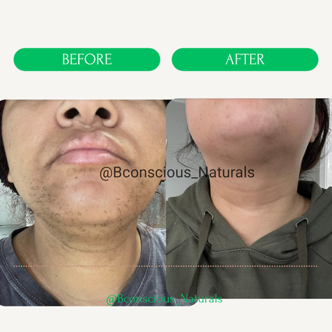 PCOS Queen Organic Spearmint Leaves(Hair Reducing Tea Blend) Hormonal Tea Blend